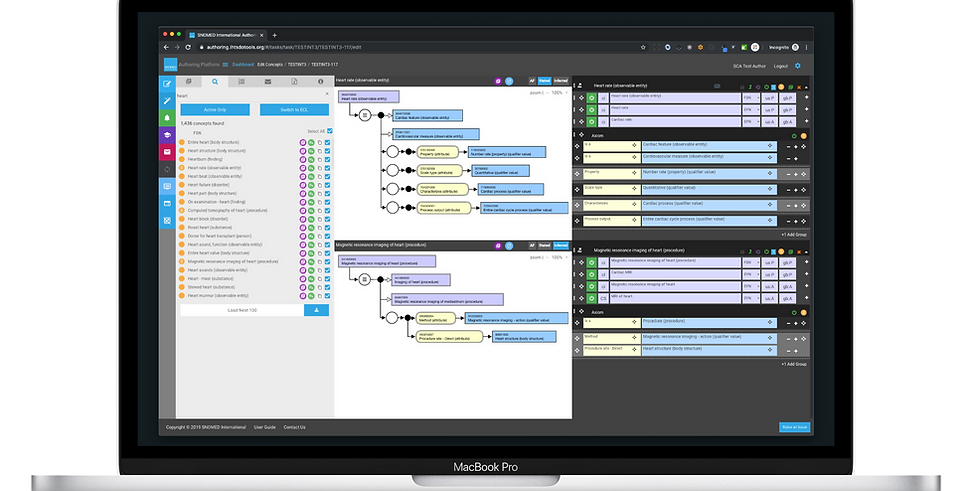 AP-V6-Editor-On-Macbook-Pro-2016.png